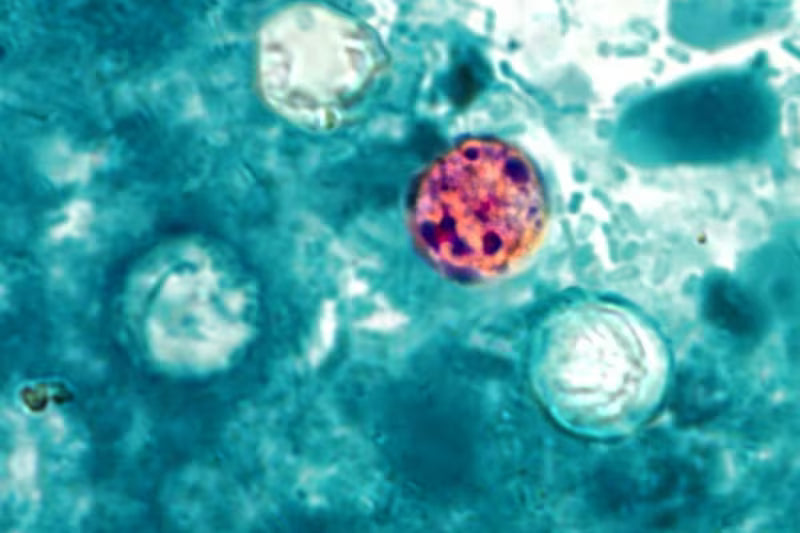 Cyclospora: What It Is and How to Protect Yourself
