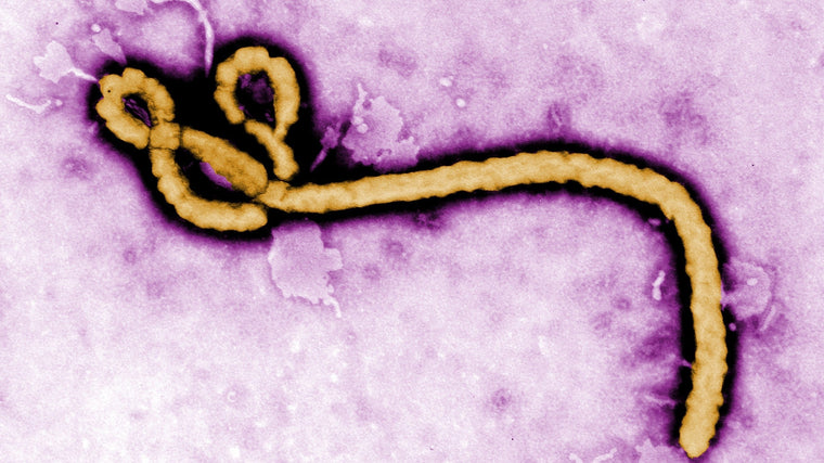 Ebola, hygiene, and the role of safe water in outbreak response